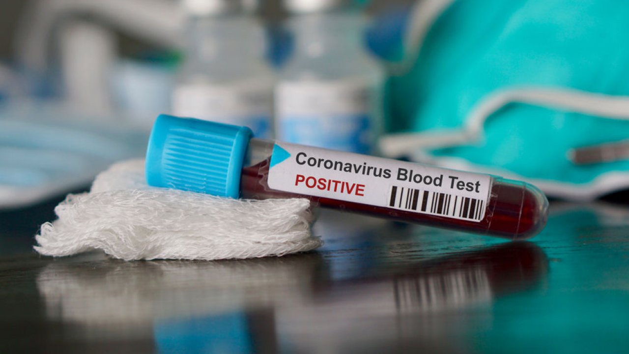 Coronavirus, un hamburger per combattere la paura